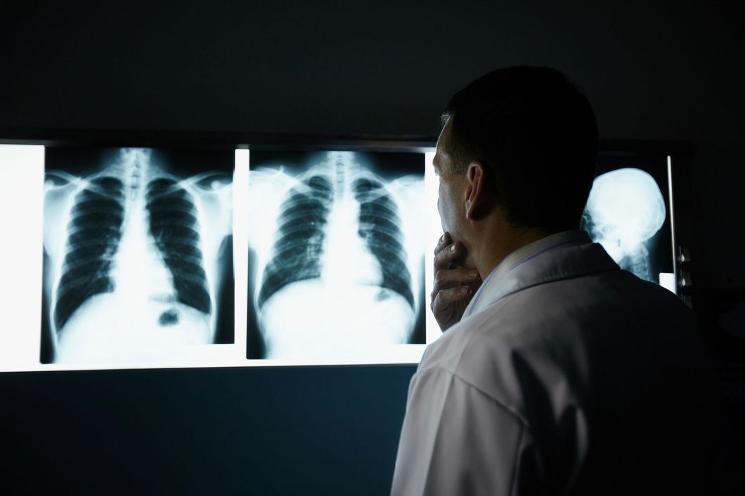 Un medico esamina delle radiografie del torace su un tavolo luminoso in una stanza buia.
