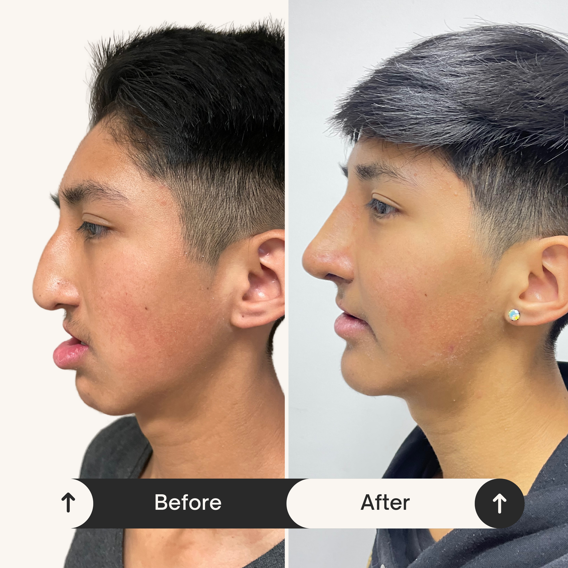 DR. JULIO CASTILLO - INCISIONES INTERNAS