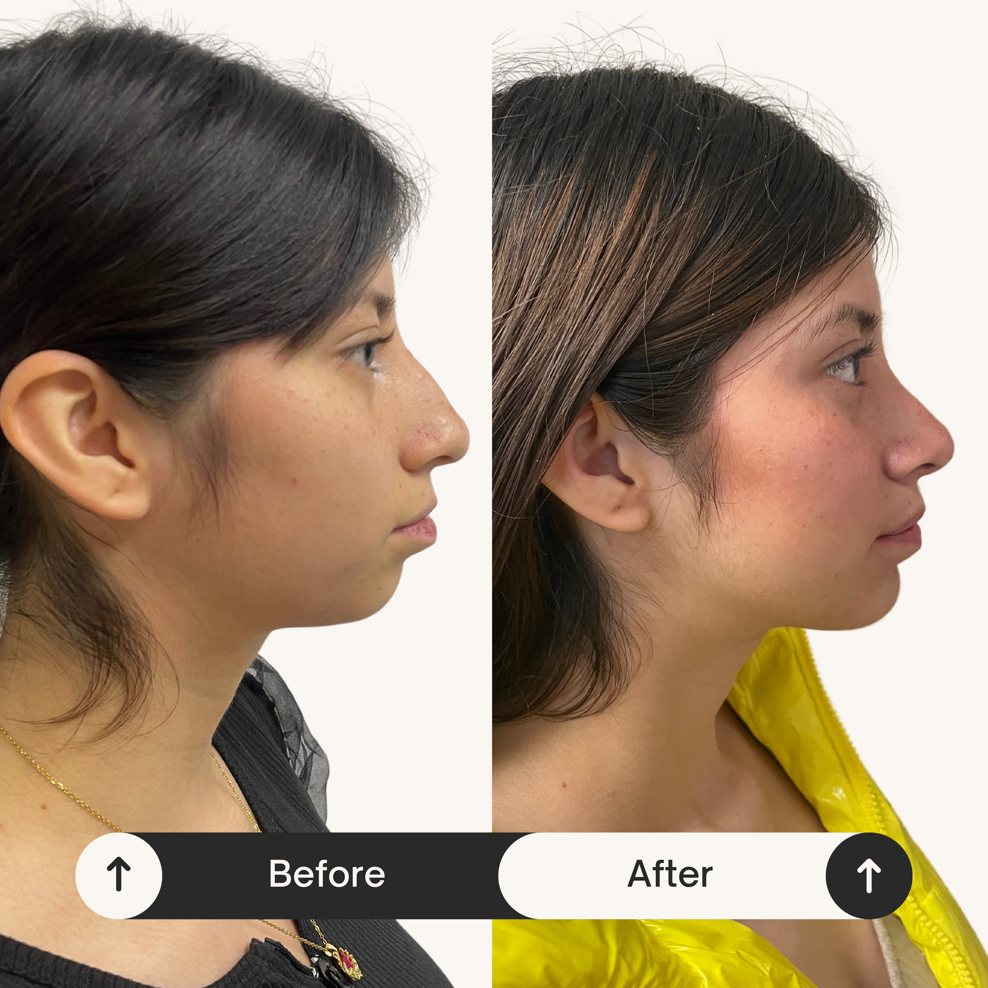 DR. JULIO CASTILLO - MINÍMA INVASIÓN