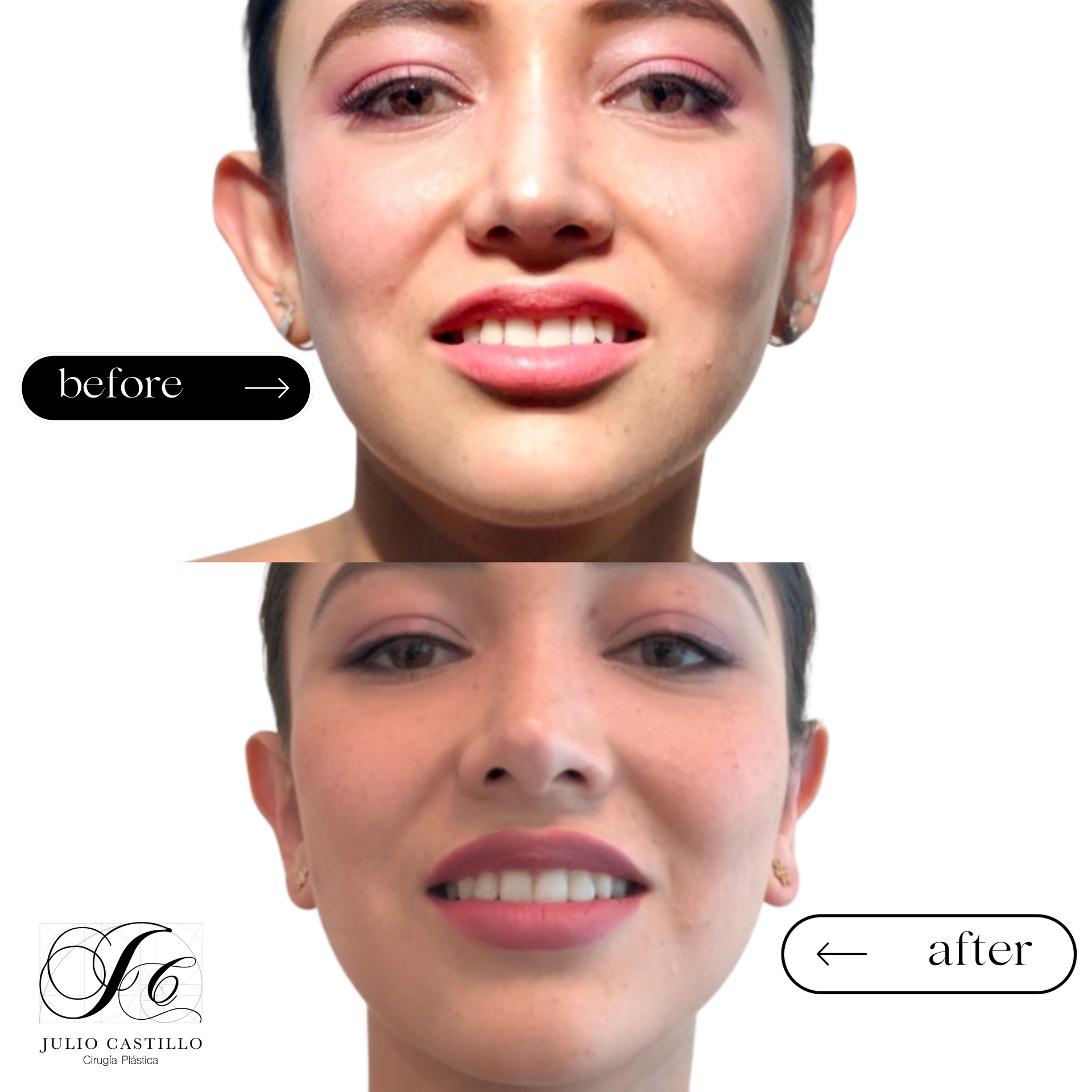 DR. JULIO CASTILLO - CARA MÁS EQULIBRADA