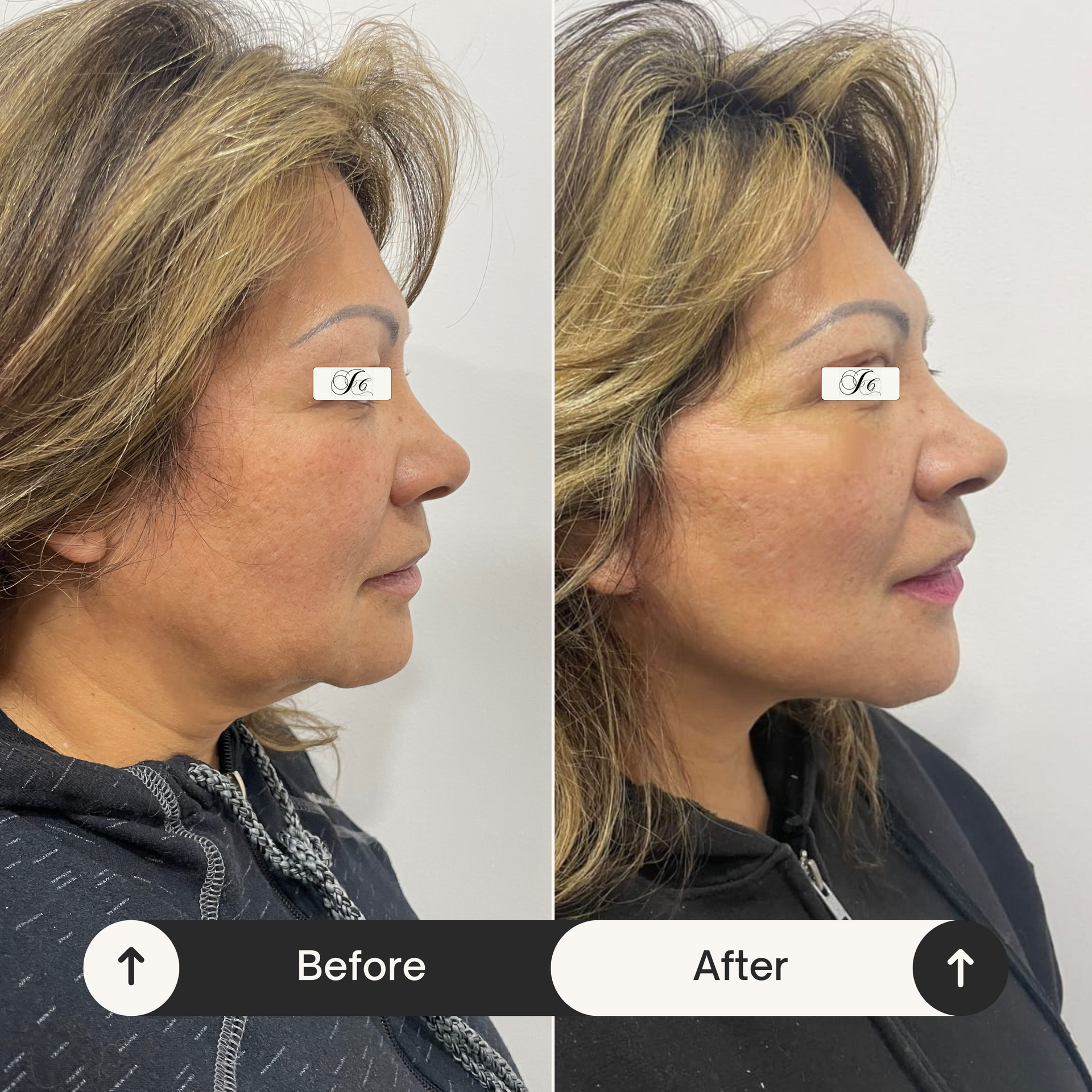 DR. JULIO CASTILLO - ROSTRO TENSO