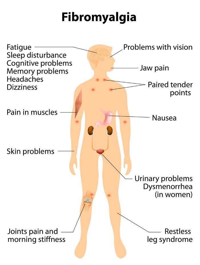 Common Symptoms of Fibromyalgia by Fibromyalgia Massage Therapist Eugene Wood, Located in Wantagh NY 11793, and Massapequa NY 11758