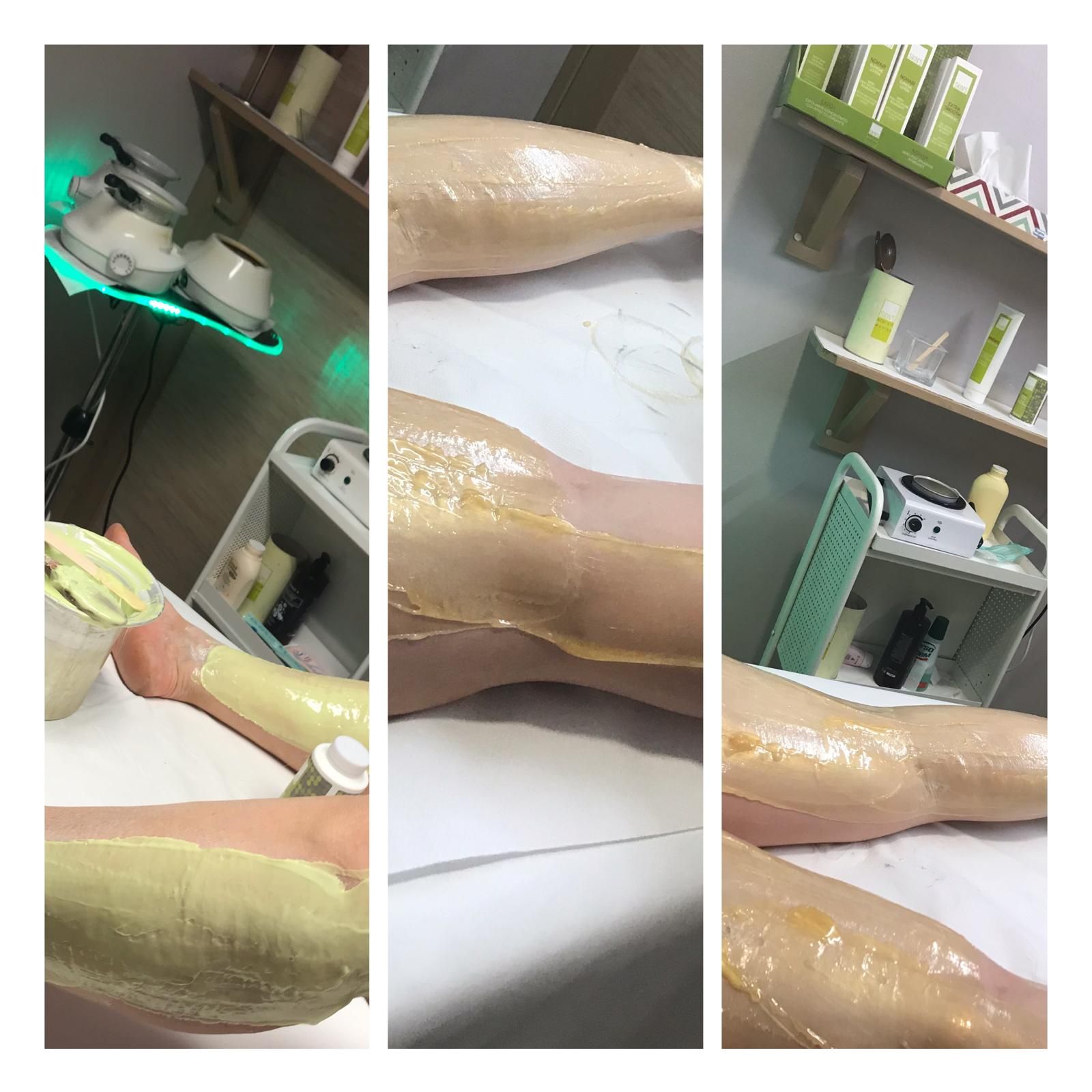 Epilazione con Metodo Brasiliano Skin’s - ESTETICA LUANA