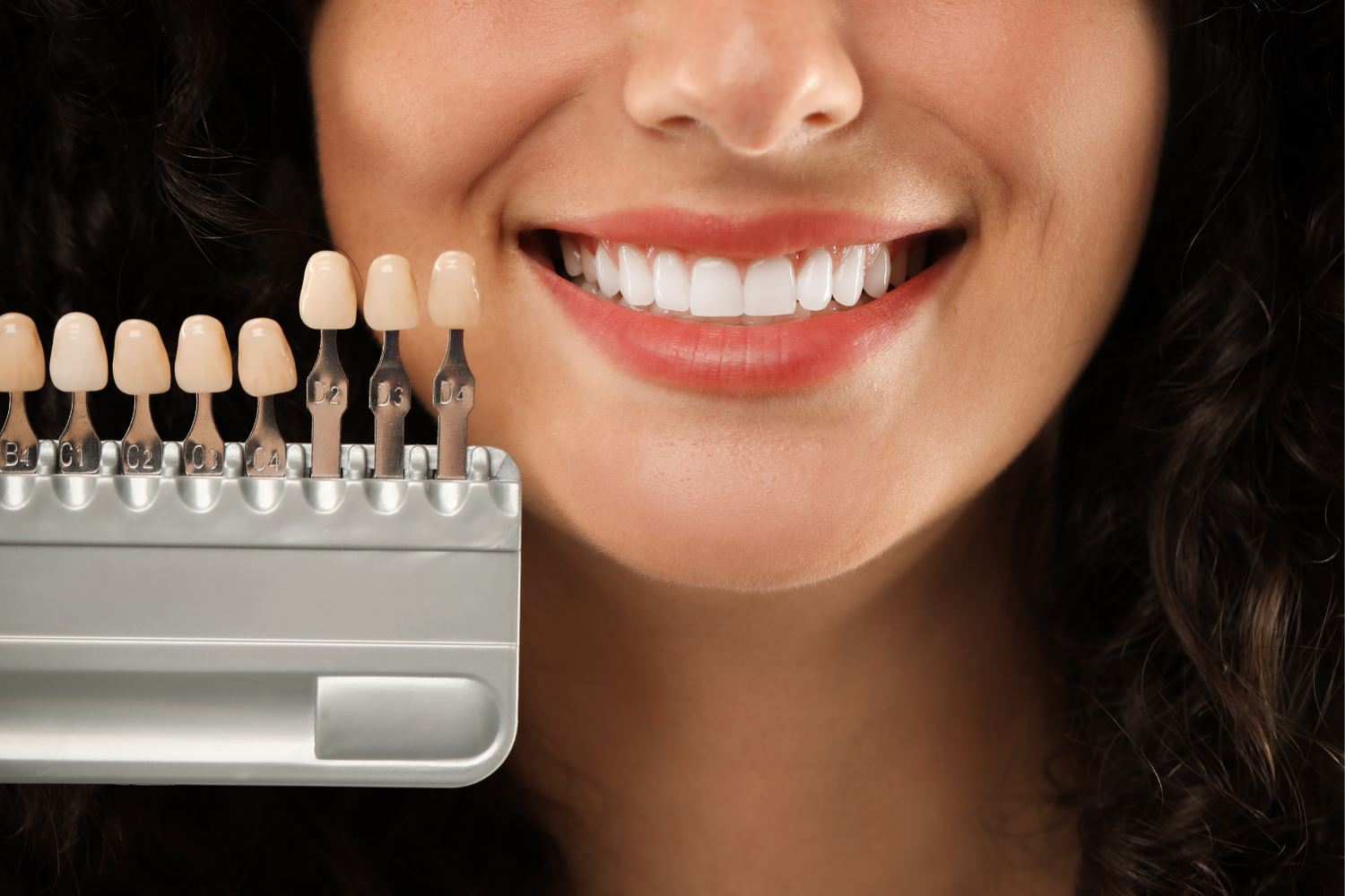Woman smiling with bright white teeth next to a dental shade guide.