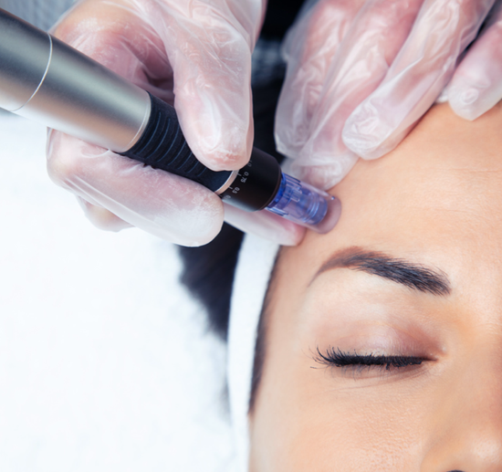 Persona aplicando cinta kinesiológica en la rodilla de un niño. Cinta rosa y azul en la rodilla.