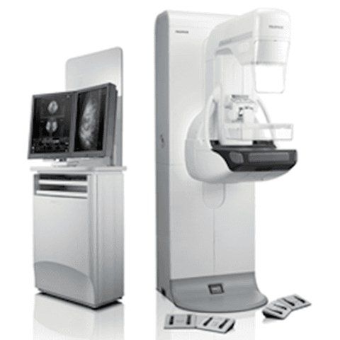 Mammografia digitale