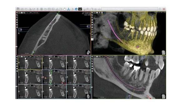 Radiografia dentii