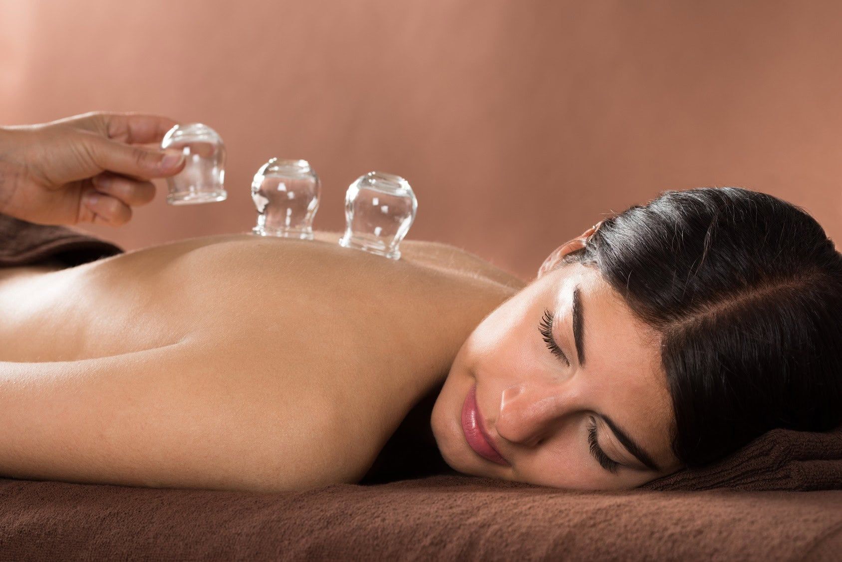 Woman receiving cupping therapy on her back; therapist holding cups.