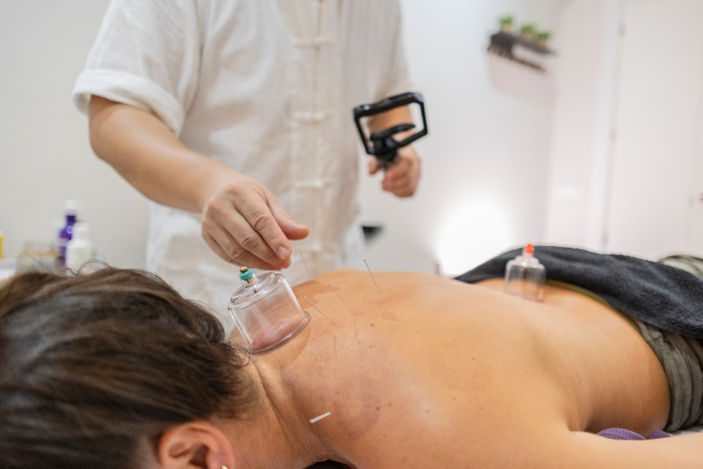 Person receiving cupping therapy on their back, therapist holding the pump, cups in place.