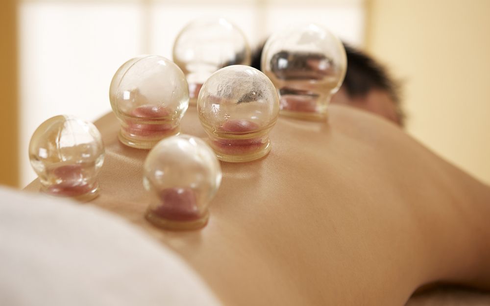 Cups on a person's back, a traditional cupping therapy. Six glass cups in place, light skin.