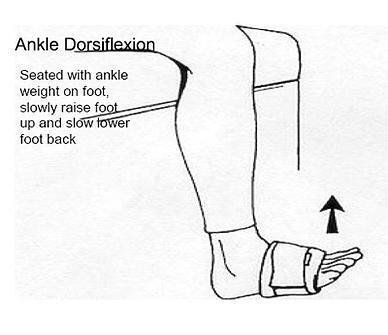 A black and white drawing of an ankle with a cast on it.