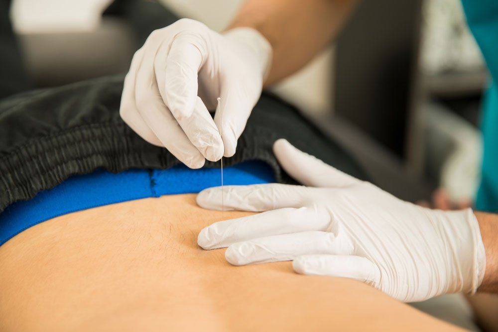 Back Needling - Massage Therapy in Grafton, NSW