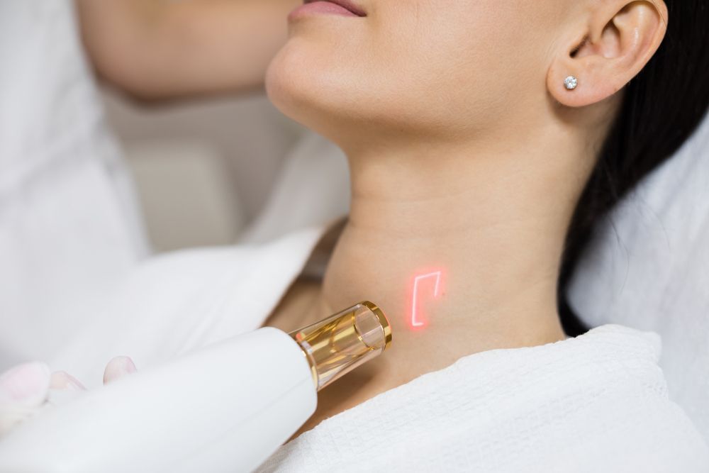 A woman is getting a laser treatment on her neck — Sibina Cosmetic Tattoo Art In Broadbeach, QLD