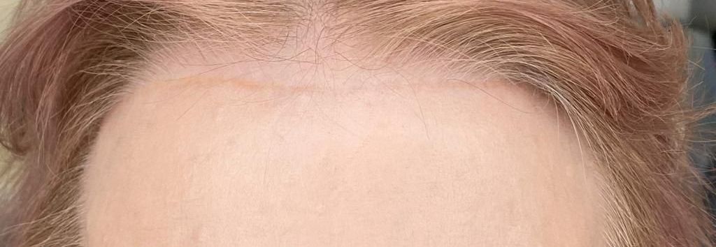 A close up of a person 's forehead with pink hair — Sibina Cosmetic Tattoo Art In Broadbeach, QLD