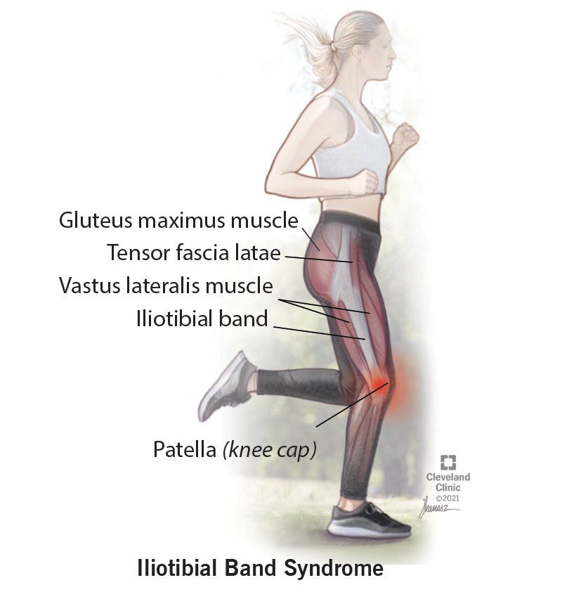 IT band syndrome, knee pain chiropractor