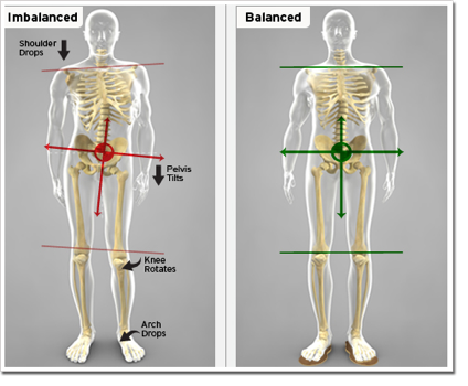 short leg, chiropractor, posture