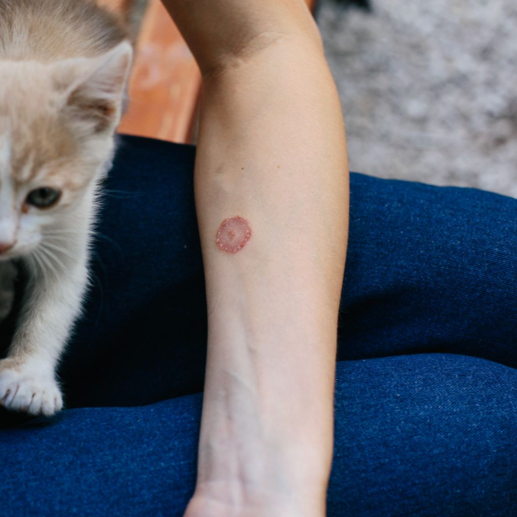Teigne chat, teigne féline, mycose chat, infection cutanée chat, symptômes teigne chat, traitement teigne chat, teigne chat contagieuse humain, prévention teigne chat, soigner teigne chat naturellement, teigne chez le chat causes et soins, consultation vétérinaire teigne chat  Entrechats Lyon, consultation vétérinaire chat, vétérinaire chat Lyon, mon chat et moi Lyon, mon chat et moi Rhône, vaccination chat Lyon, médecine féline, soins chat, vétérinaire félin Rhône, check-up chat, prévention santé chat, vétérinaire comportement chat, chat stressé vétérinaire, chat agressif vétérinaire, comportement félin, clinique Cat Friendly Lyon, bien-être félin, soins doux chat, apaiser chat, hospitalisation chat, chirurgie féline, anesthésie chat, soins post-opératoires chat, hôpital vétérinaire Rhône, clinique féline Lyon, surveillance vétérinaire chat, chirurgie douce chat, nutrition féline, alimentation chat, prévention maladies chat, conseils vétérinaires chat, suivi de poids chat, santé féline Lyon, vétérinaire nutrition chat,clinique Cat Friendly Lyon, équipe vétérinaire chats, vétérinaire félin Lyon, médecine du chat, bien-être félin, soins respectueux, spécialiste chat Lyon, conseils vétérinaires chat, blog chat, santé du chat, comportement félin, soins chat Lyon, prévention chat
