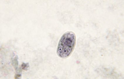 Teigne chat, teigne féline, mycose chat, infection cutanée chat, symptômes teigne chat, traitement teigne chat, teigne chat contagieuse humain, prévention teigne chat, soigner teigne chat naturellement, teigne chez le chat causes et soins, consultation vétérinaire teigne chat  Entrechats Lyon, consultation vétérinaire chat, vétérinaire chat Lyon, mon chat et moi Lyon, mon chat et moi Rhône, vaccination chat Lyon, médecine féline, soins chat, vétérinaire félin Rhône, check-up chat, prévention santé chat, vétérinaire comportement chat, chat stressé vétérinaire, chat agressif vétérinaire, comportement félin, clinique Cat Friendly Lyon, bien-être félin, soins doux chat, apaiser chat, hospitalisation chat, chirurgie féline, anesthésie chat, soins post-opératoires chat, hôpital vétérinaire Rhône, clinique féline Lyon, surveillance vétérinaire chat, chirurgie douce chat, nutrition féline, alimentation chat, prévention maladies chat, conseils vétérinaires chat, suivi de poids chat, santé féline Lyon, vétérinaire nutrition chat,clinique Cat Friendly Lyon, équipe vétérinaire chats, vétérinaire félin Lyon, médecine du chat, bien-être félin, soins respectueux, spécialiste chat Lyon, conseils vétérinaires chat, blog chat, santé du chat, comportement félin, soins chat Lyon, prévention chat