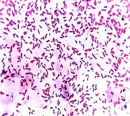 Microscopic View of Numerous Rod-shaped Bacteria — NatureWise Pest Control In Port Macquarie, NSW