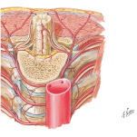 Cross-section drawing of spinal cord, vertebrae, and surrounding tissue, with a cylindrical object in the foreground.