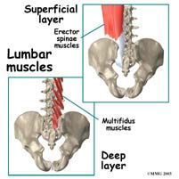 Diagram showing lumbar muscles