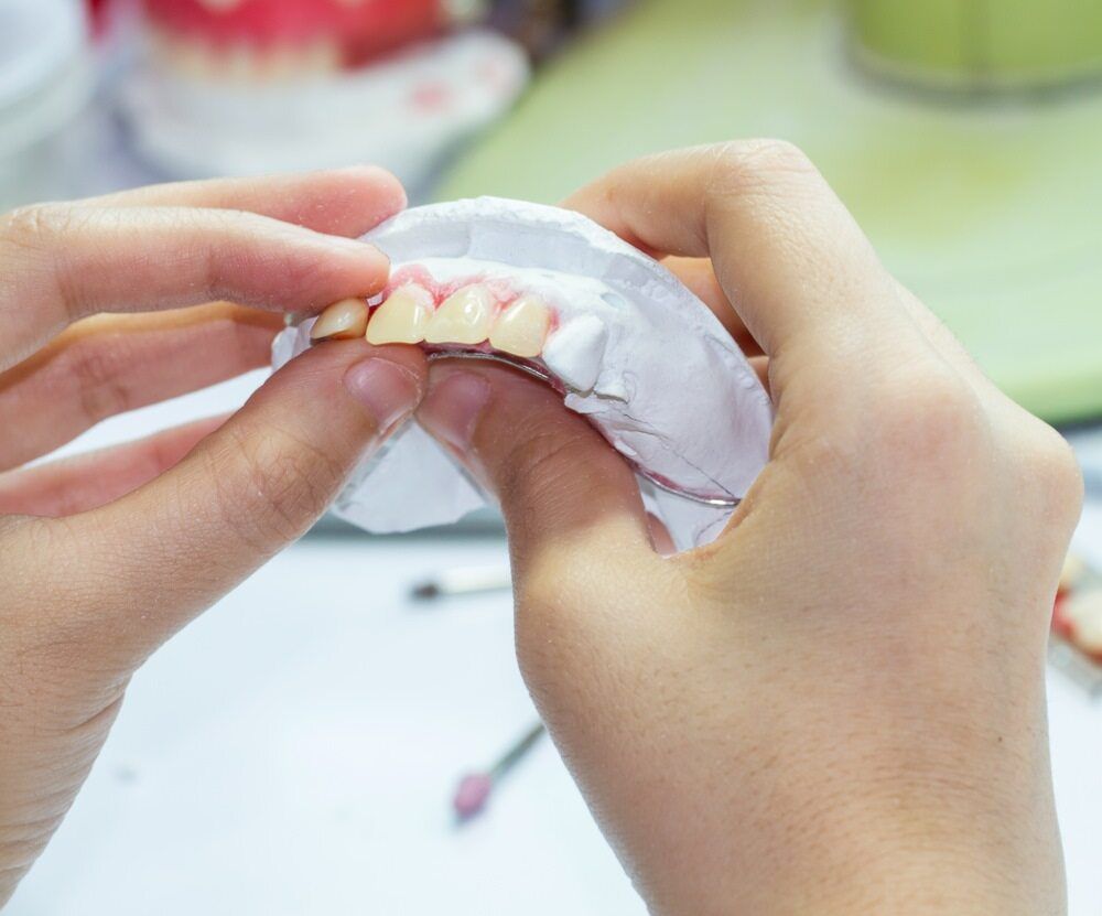 A Person Is Holding A Model Of Teeth In Their Hands — Highlands Denture Clinic in Willow Vale, NSW