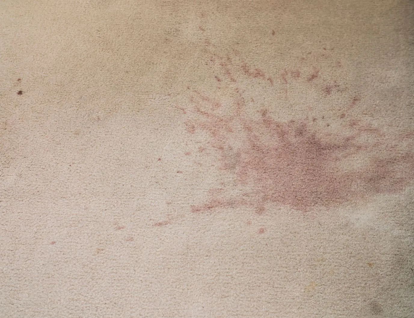 A close up of a person 's skin with red spots on it.