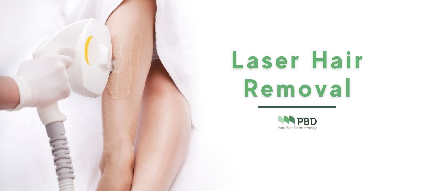 Laser Hair Removal: Benefits, Side Effects, Results | Pinebelt Derm, MS