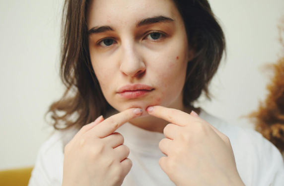 Fall and Acne: Why Breakouts Increase in Cooler Weather & How to Prevent Them | Pine Belt