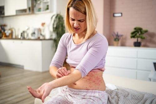 The Link Between Stress & Skin Conditions | Pine Belt Dermatolog