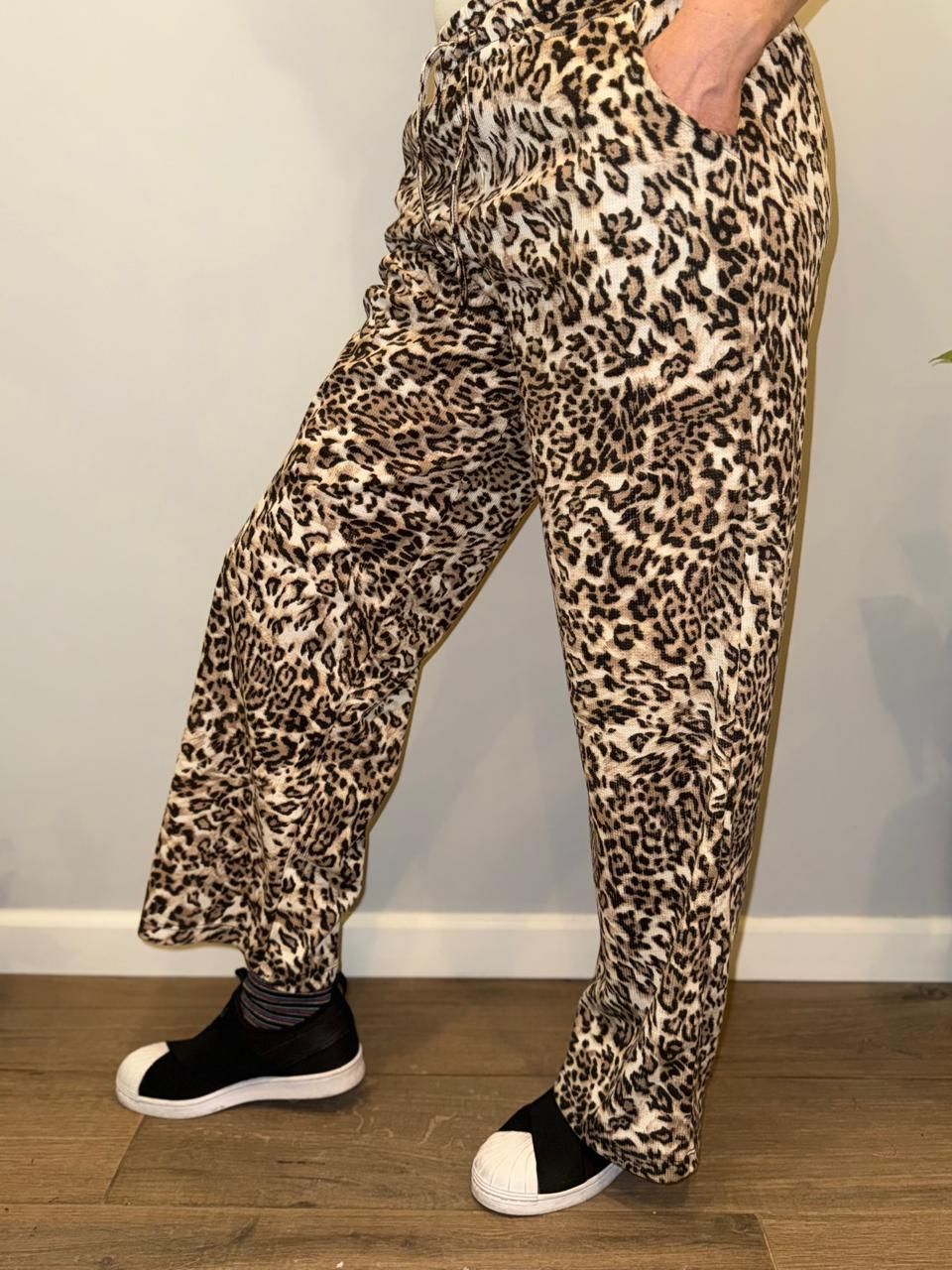 Persona que viste pantalones con estampado de guepardo, con una mano en el bolsillo y zapatos negros.