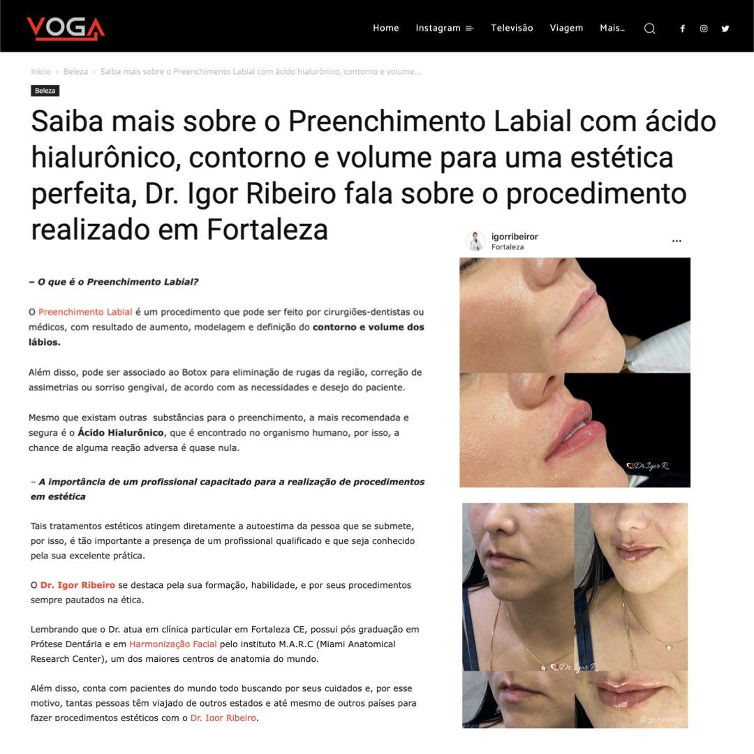 Dr. Igor Ribeiro | Igor Ribeiro Rola procedimento da moda Augemagazine harmonização facial em fortaleza