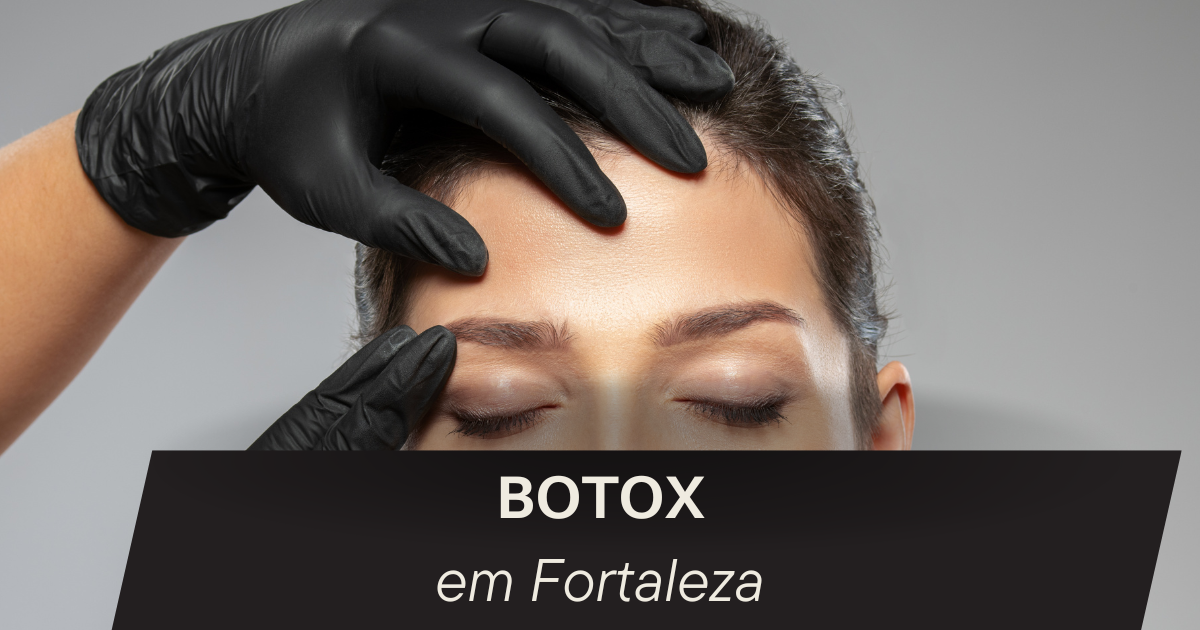 Botox em Fortaleza
