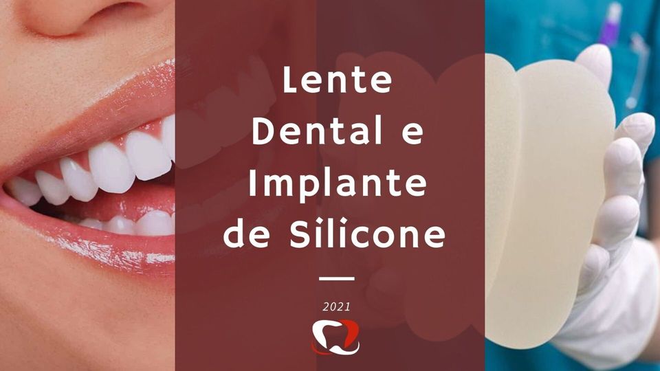Implante Silicone e Lente de Contato Dental em Fortaleza Banner Blog