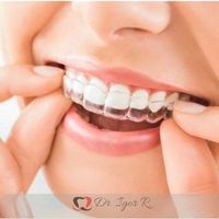sorriso mostrando uma placa de clareamento dental caseiro, clinica em fortaleza também oferece o tratamento de clareamento dental a laser e branqueamento dentário, dentista em fortaleza