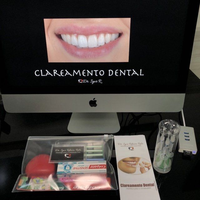 Kit de clareamento dental caseiro com foto antes e depois paciente clareamento dentário