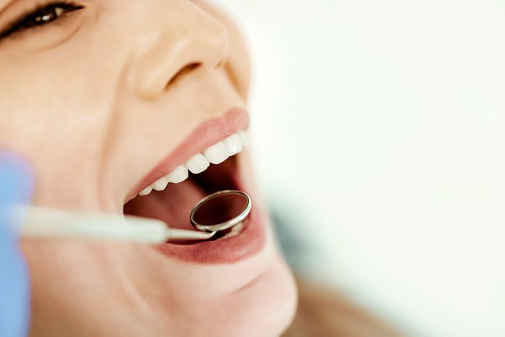 Woman with mouth open during a dental exam, using a small mirror.