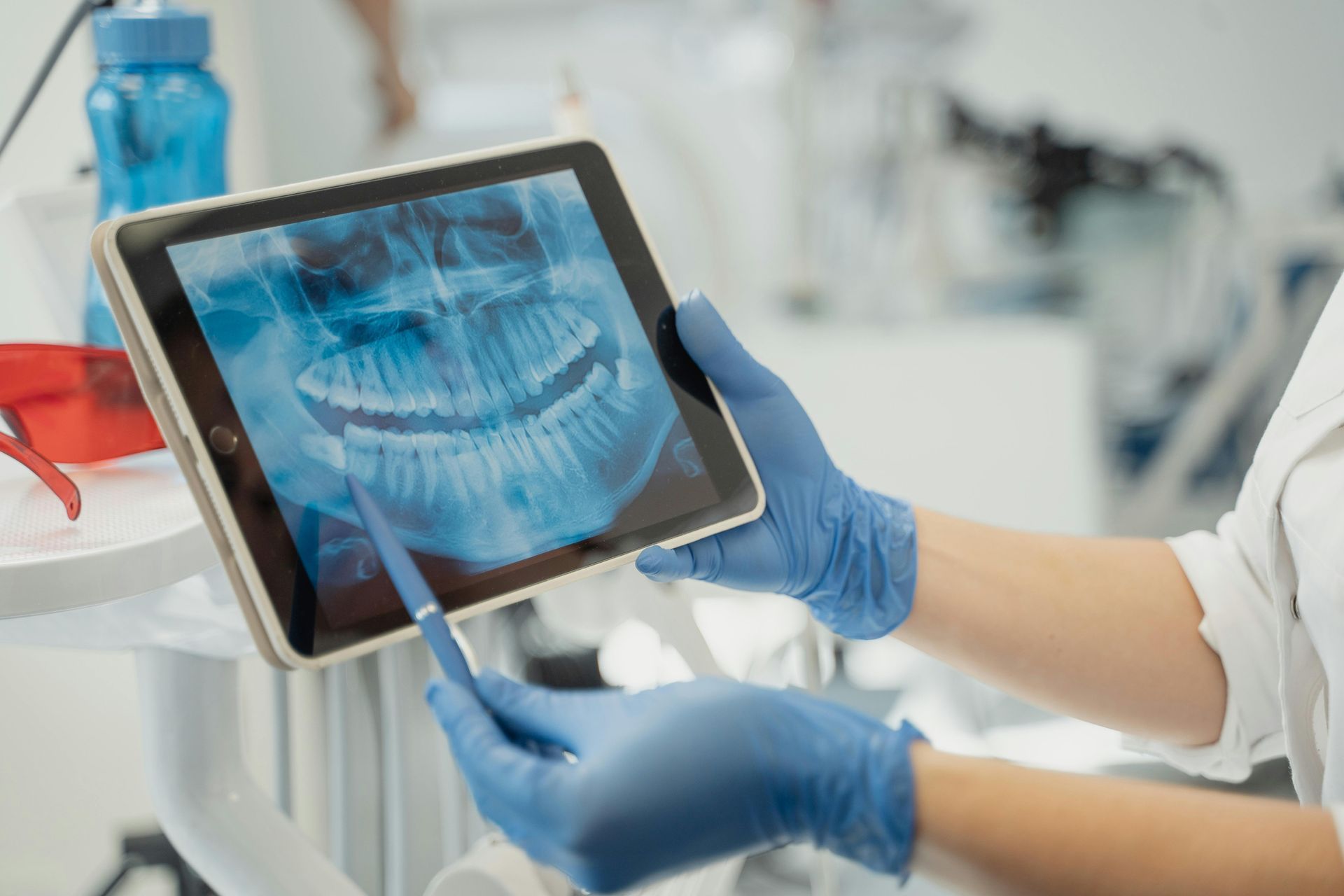 Dentist in blue gloves points at a dental X-ray on a tablet in a clinic setting.