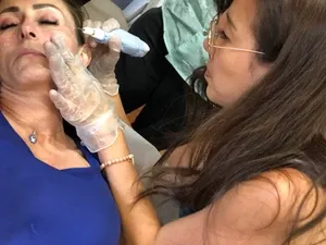 Beautiful woman doing fibroblast | Sylmar, CA | Rave Beauty Bar