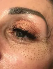 Eye with fibroblast | Sylmar, CA | Rave Beauty Bar