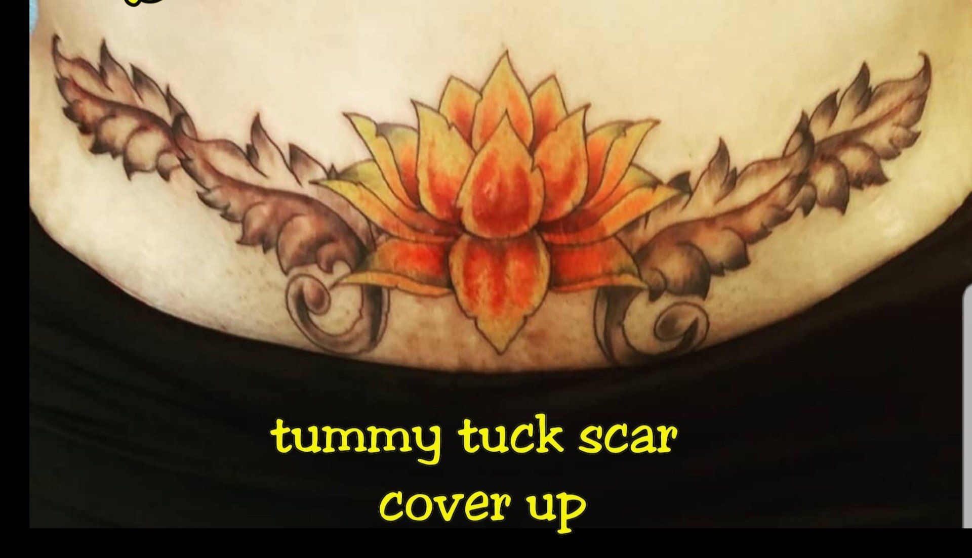 Jess Tummy Tuck Scar Cover — San Antonio, TX — Skin Graphics Tattoos & Body Piercing