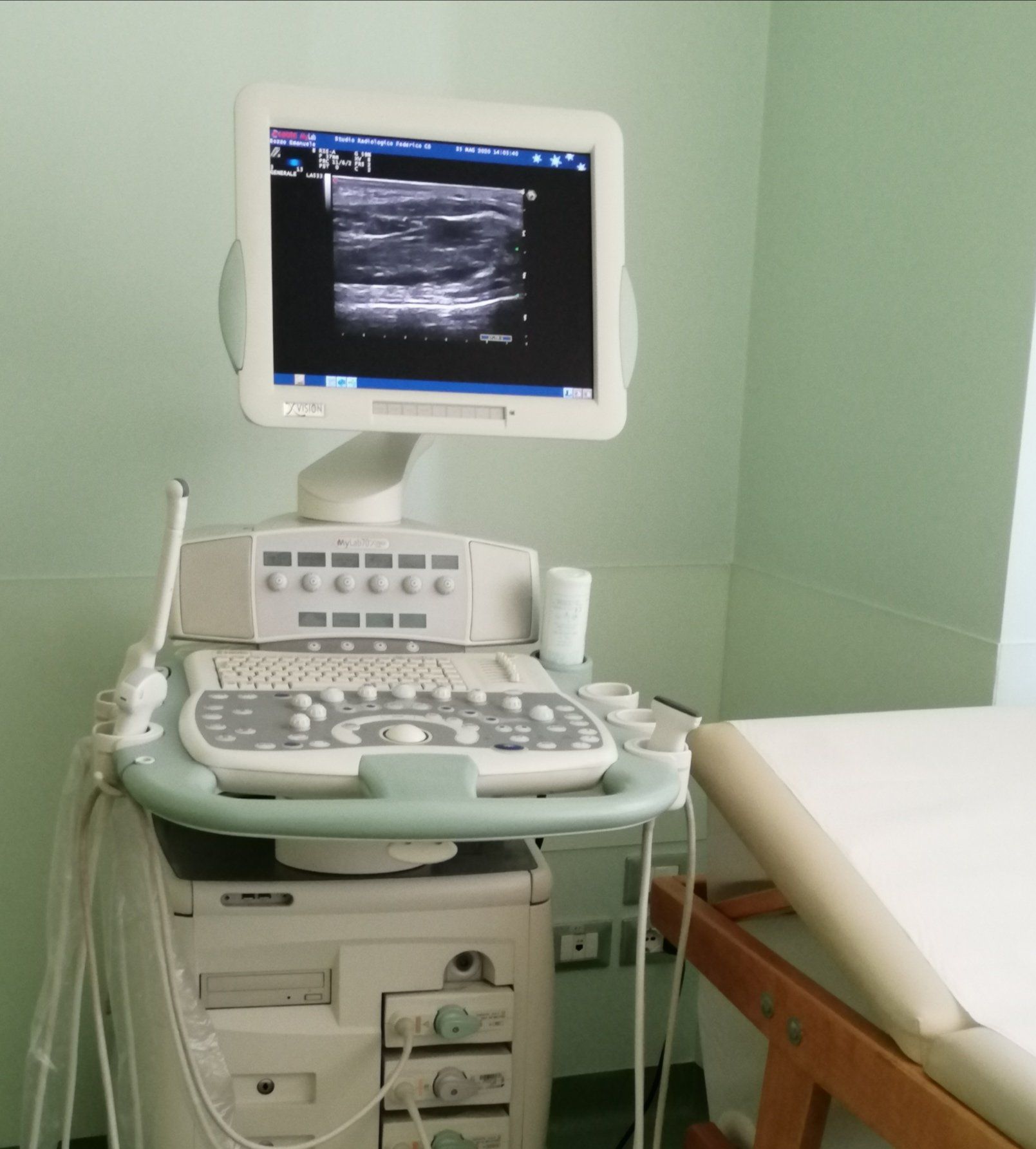 Ecografia e ecocolordoppler