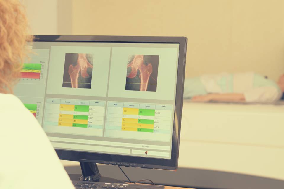 MOC (densitometria ossea)