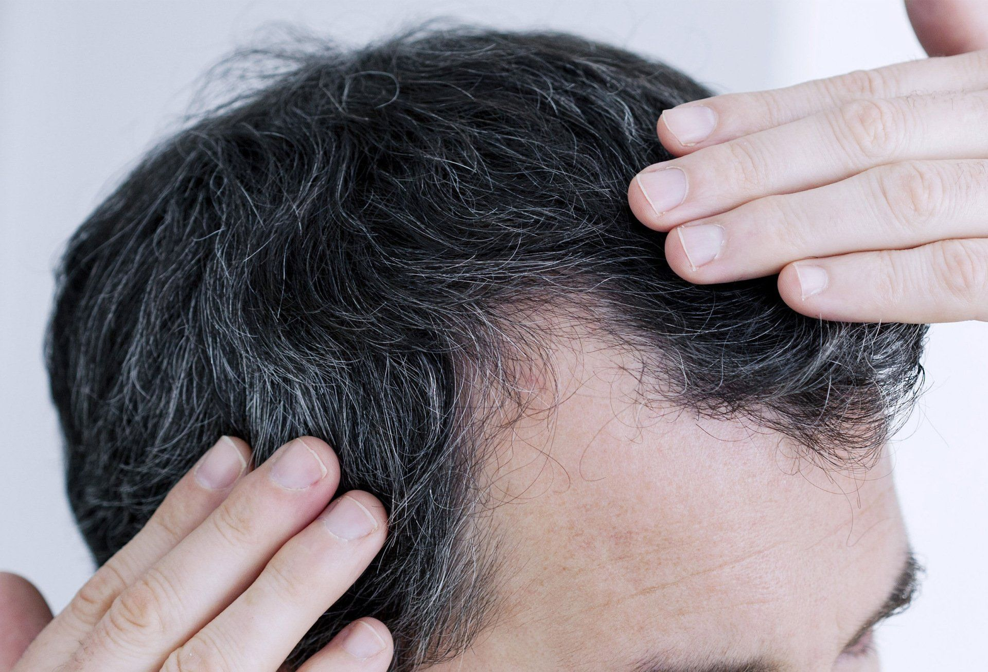 Man touching hairline, dark hair with signs of thinning and graying near the forehead.