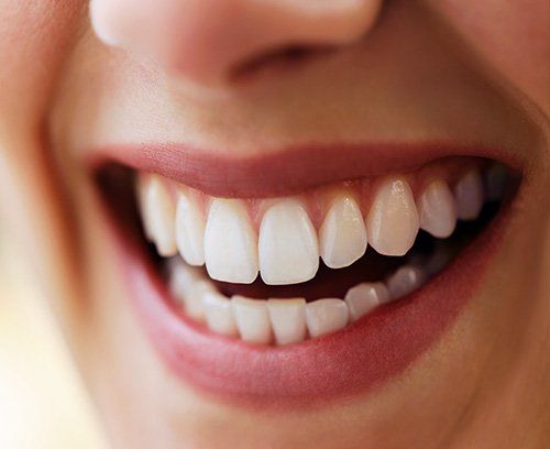 Teeth whitening closeup