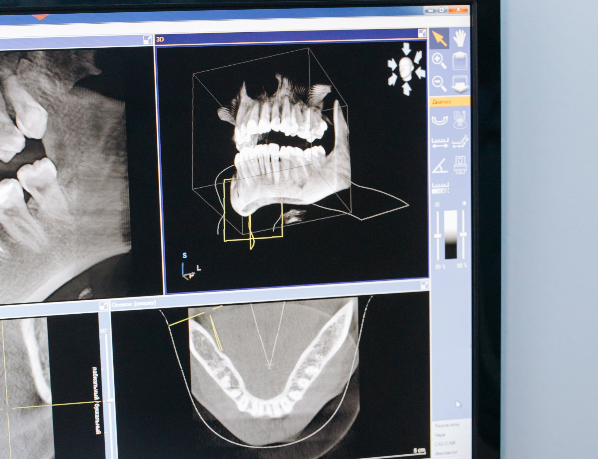 dental x ray images