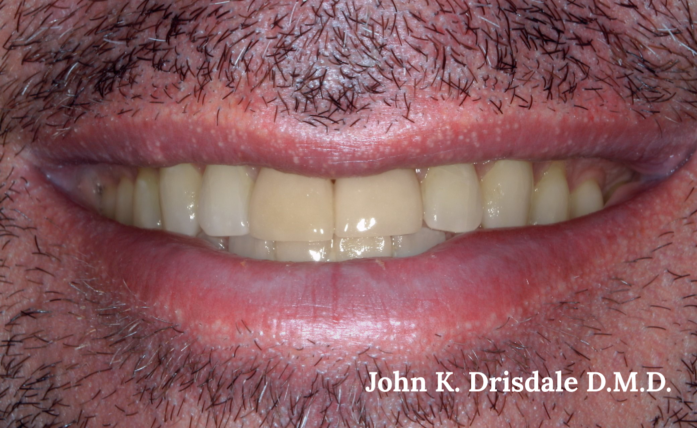 A close up of a man 's smile with the name john k. driscole d.m.d. on the bottom