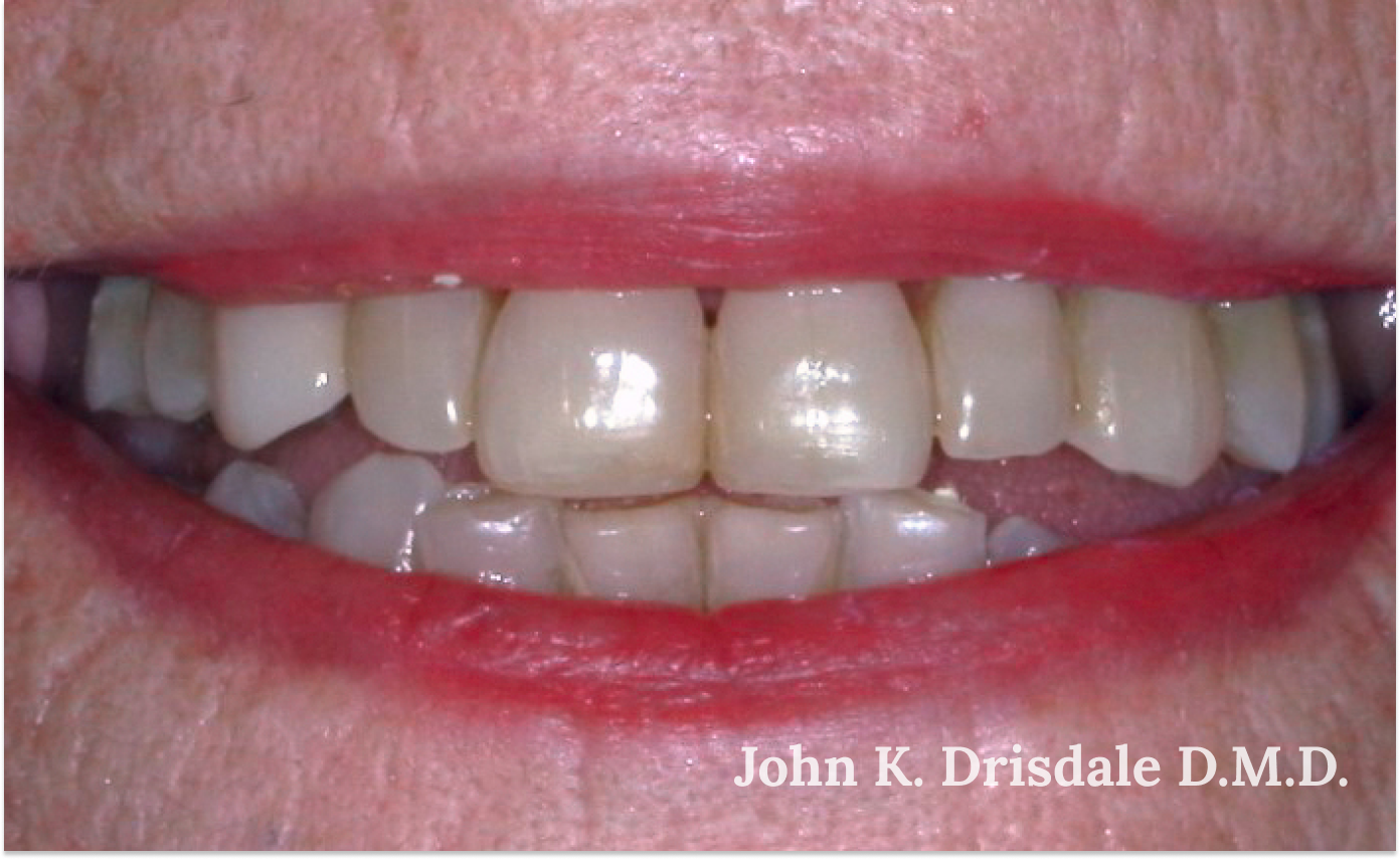 A close up of a woman 's teeth by john k. driscole d.m.d.