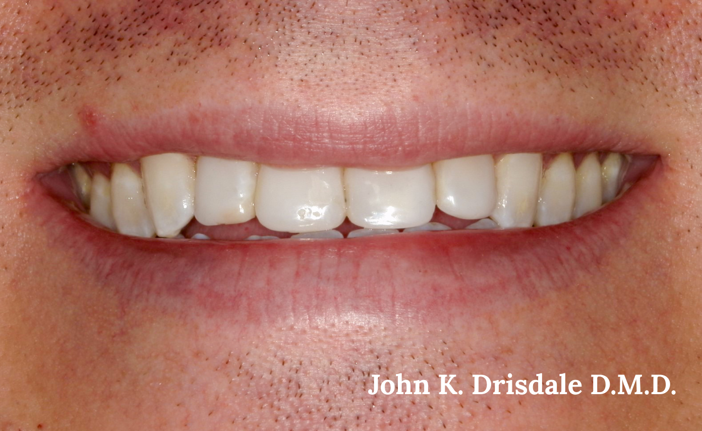 A close up of a man 's teeth with john k. driscole d.m.d. written on the bottom