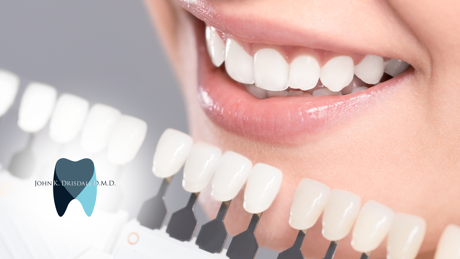 A close up of a woman 's teeth with a tooth in the background.